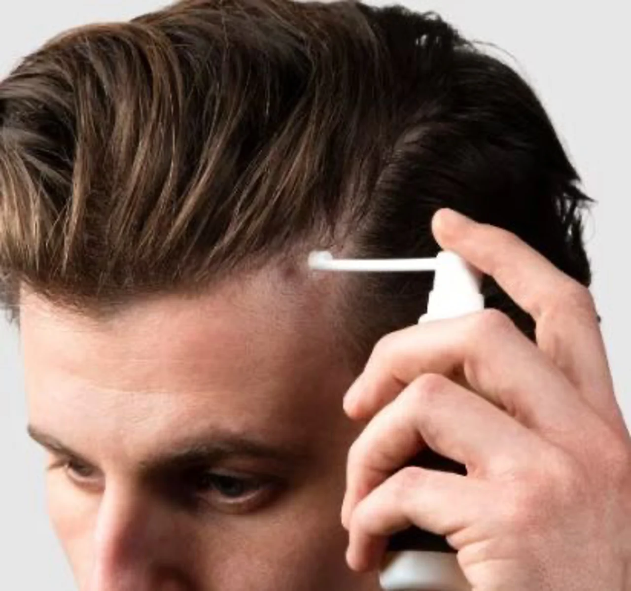 ماینوکسیدیل و طریقه‌ی مصرف آن در درمان ریزش مو